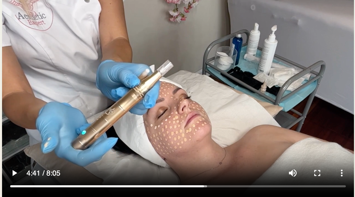 Microneedling &amp; BB glow training online -FR